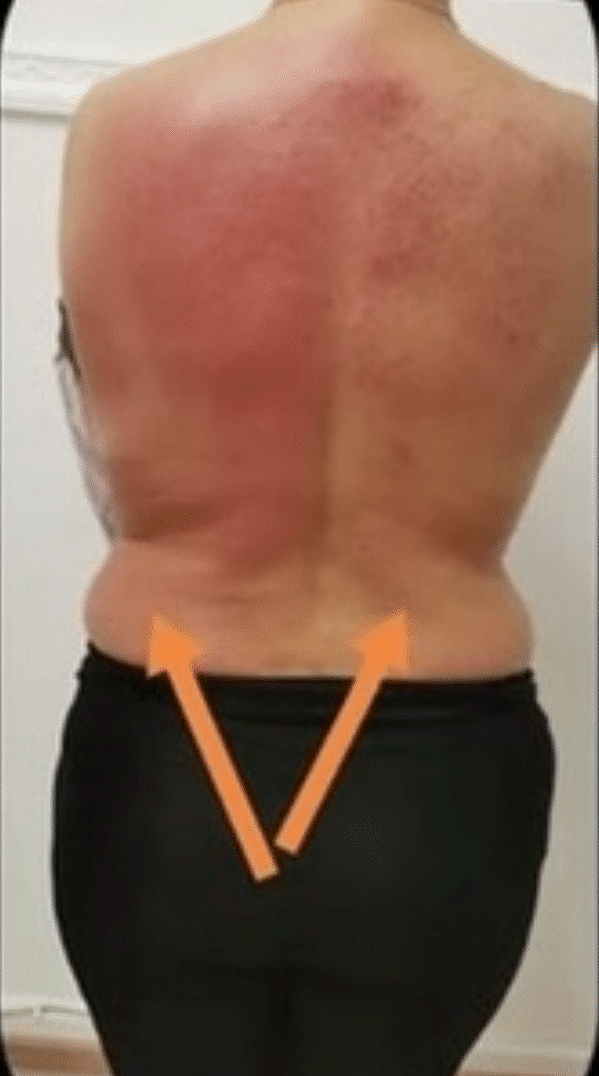 After Image: T-Shape 2 - back