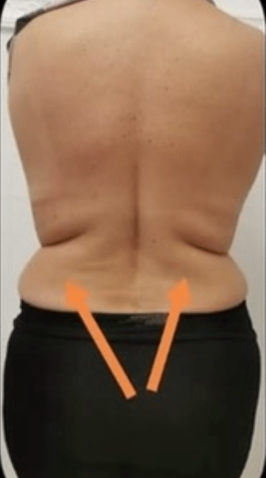Before Image: T-Shape 2 - back