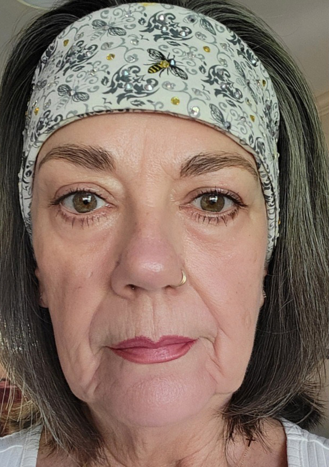 After Image: Anti-Aging Protocol - front