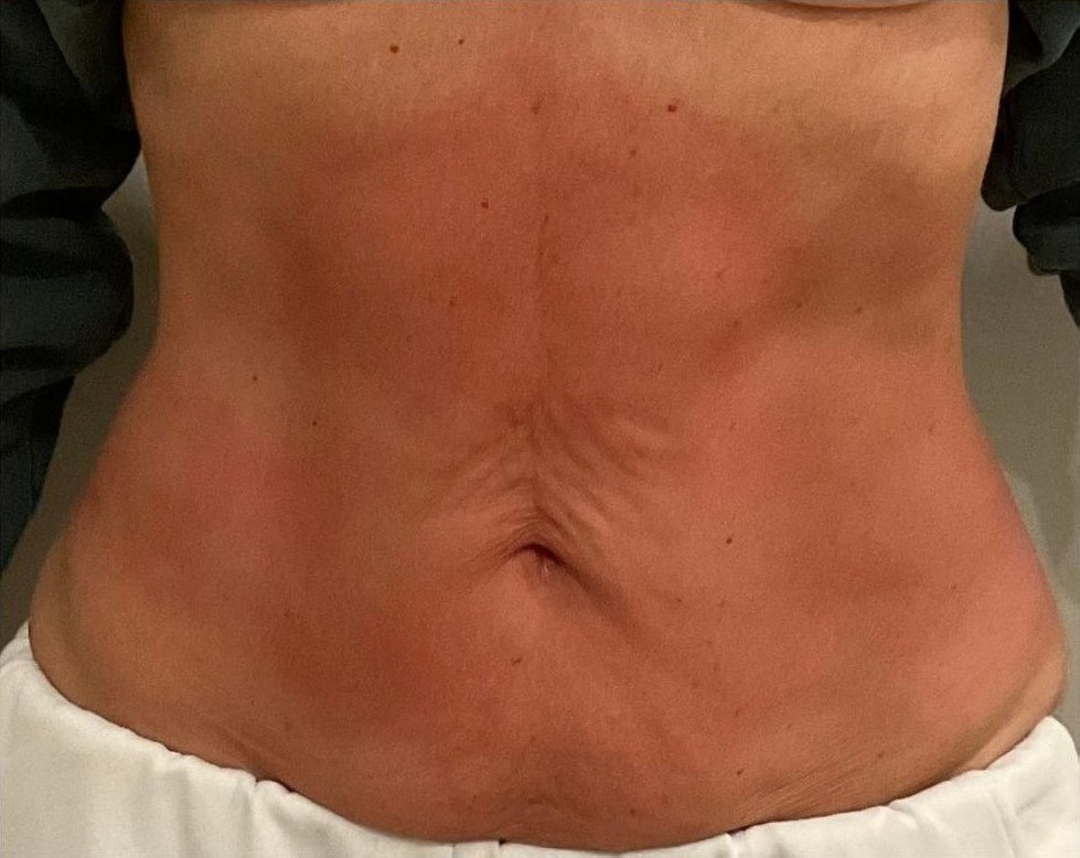 After Image: T-Shape 2 - front