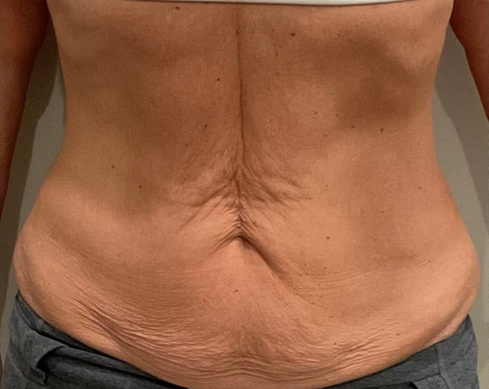 Before Image: T-Shape 2 - front