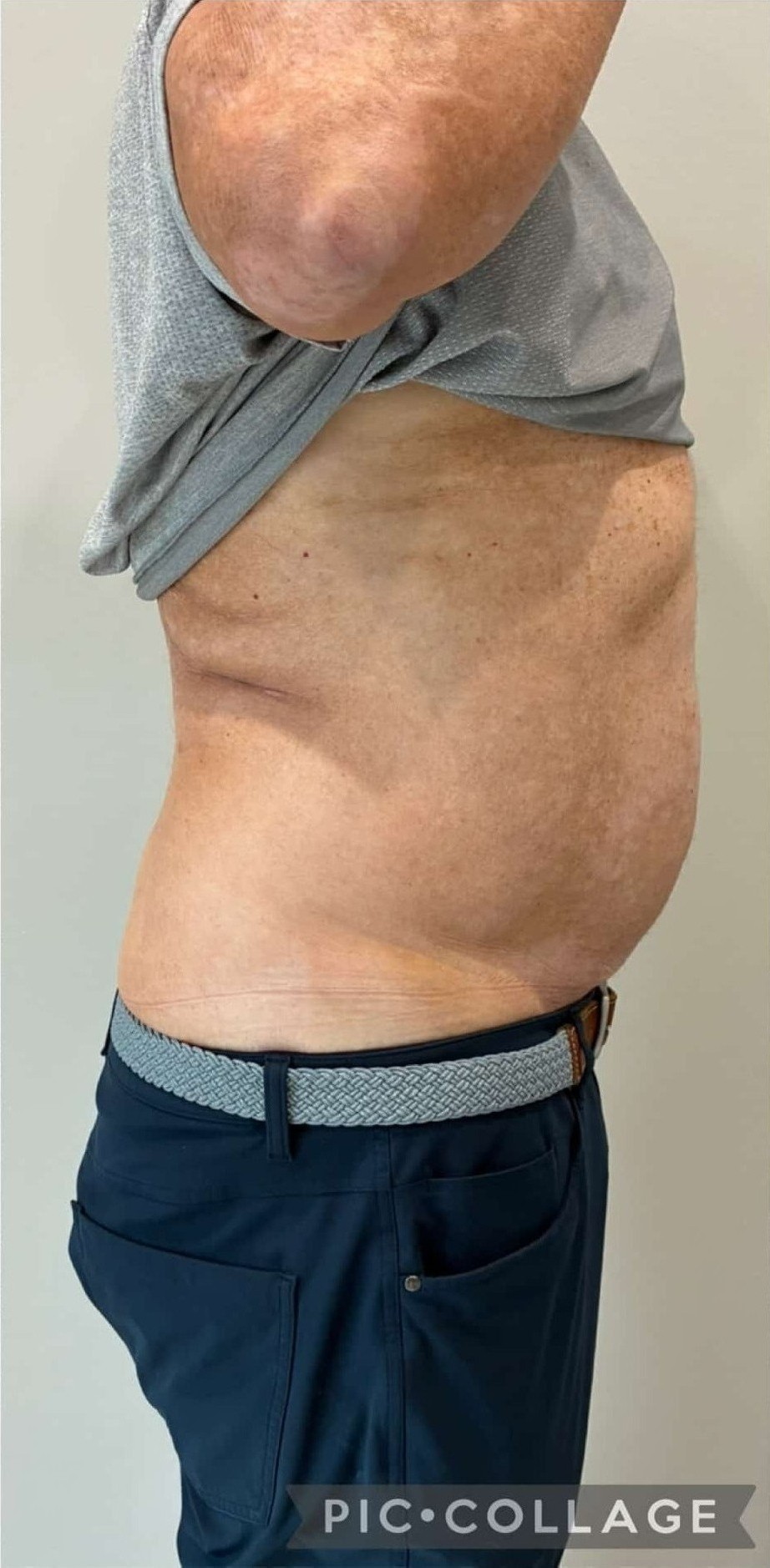 After Image: T-Shape 2 - right-side