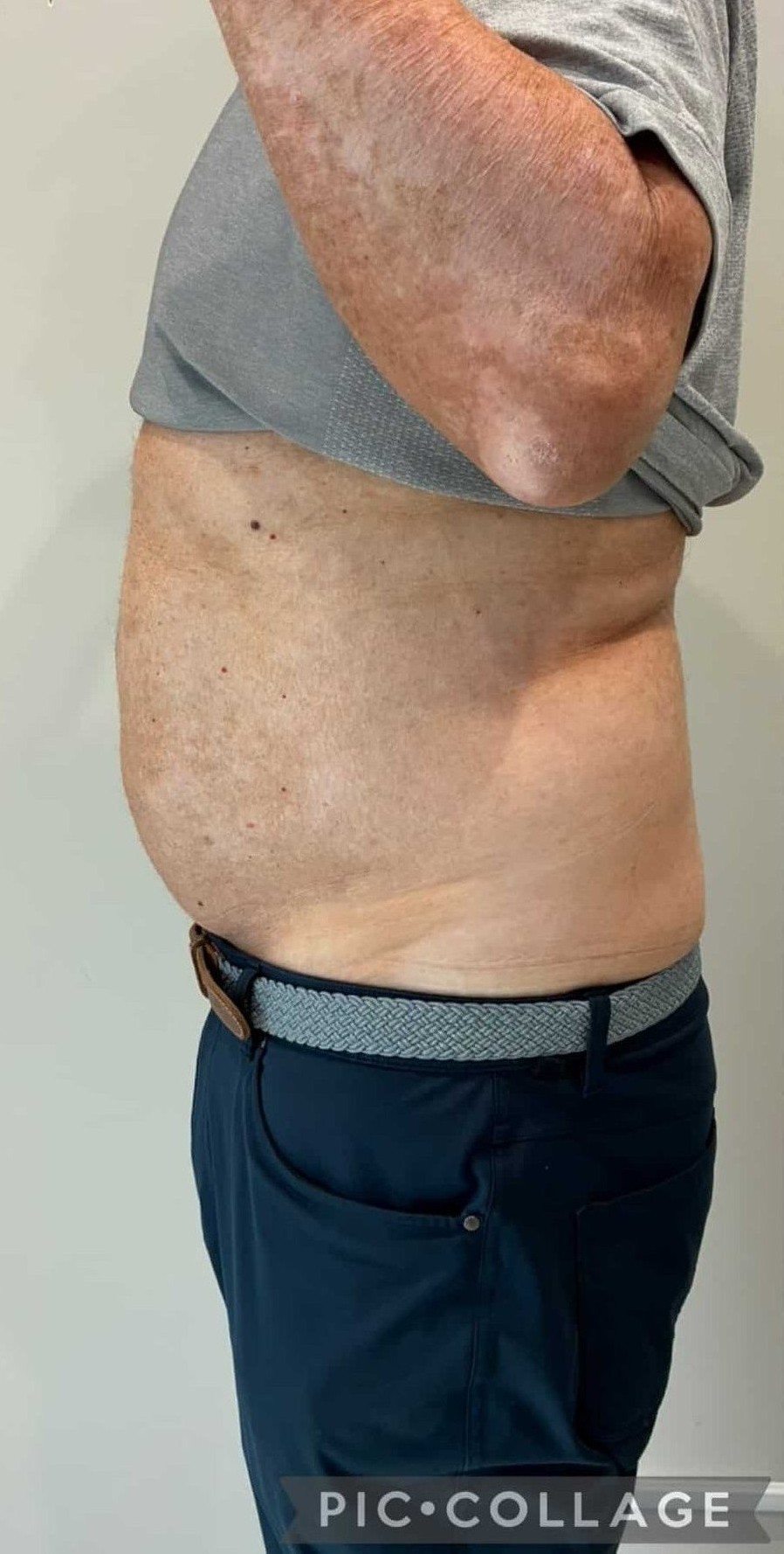 After Image: T-Shape 2 - left-side