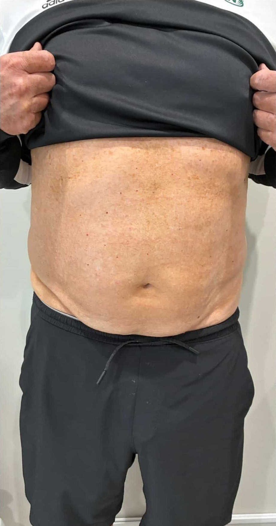 Before Image: T-Shape 2 - front