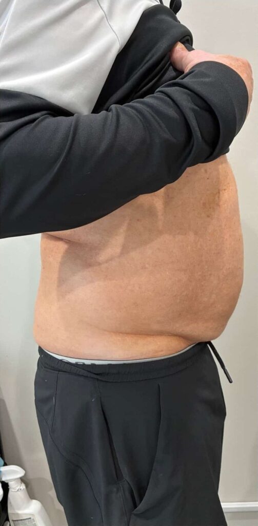 Before Image: T-Shape 2 - right-side