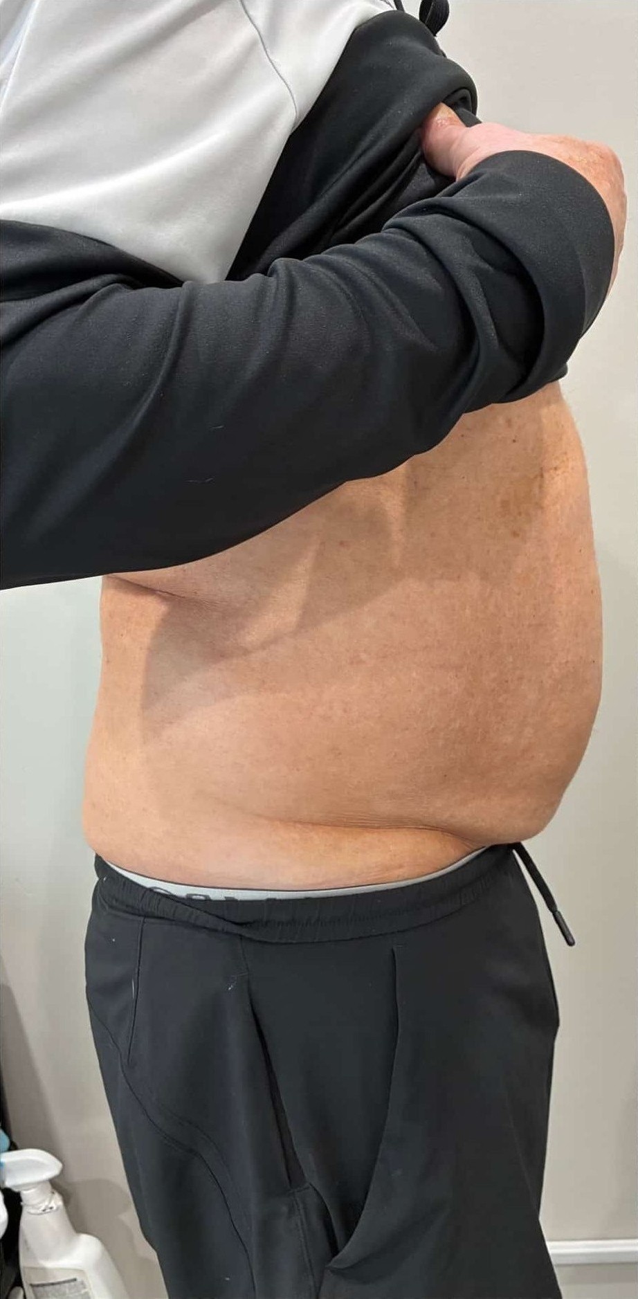 Before Image: T-Shape 2 - right-side