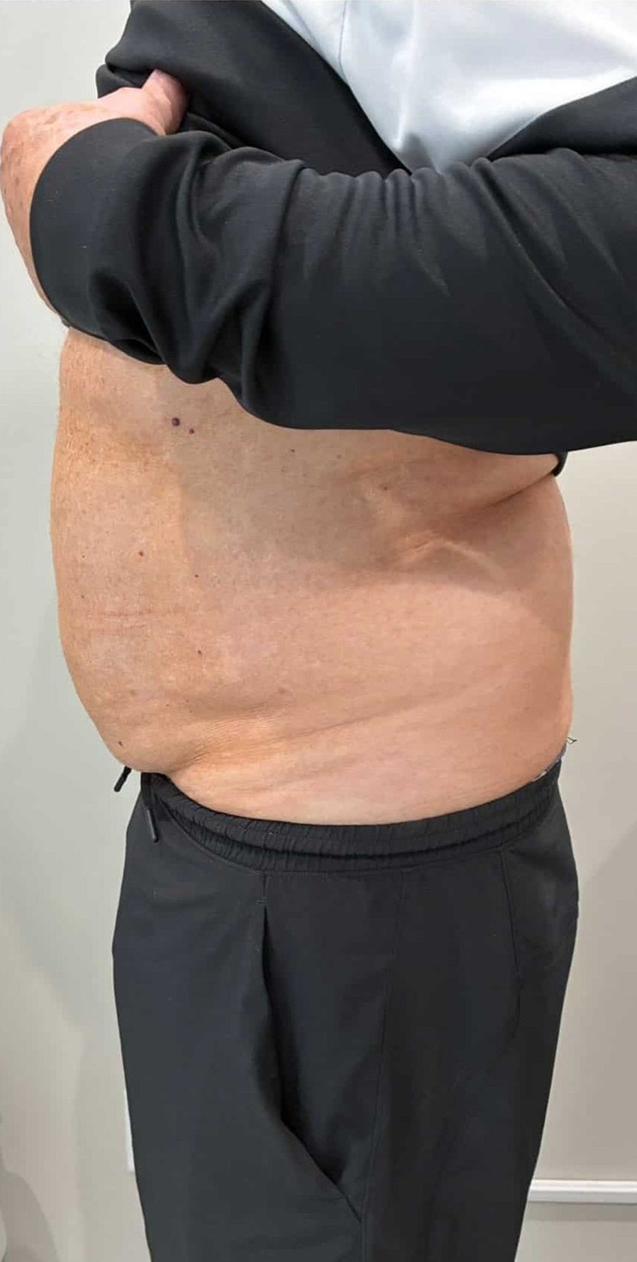 Before Image: T-Shape 2 - left-side