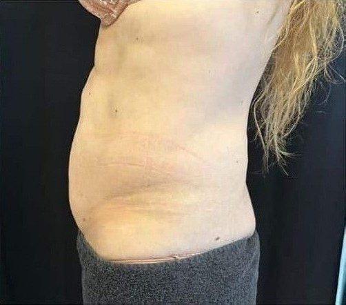After Image: T-Shape 2 - left-side