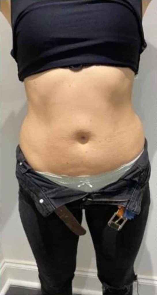Before Image: T-Shape 2 - front