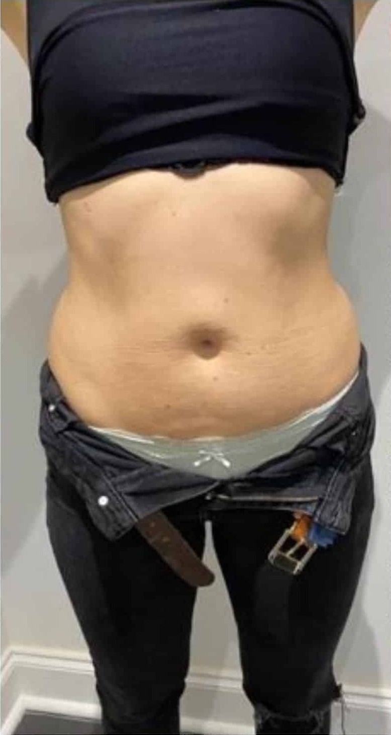 Before Image: T-Shape 2 - front