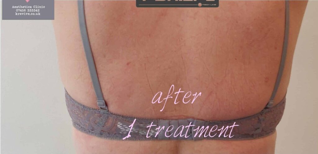 After Image: T-Shape 2 - back