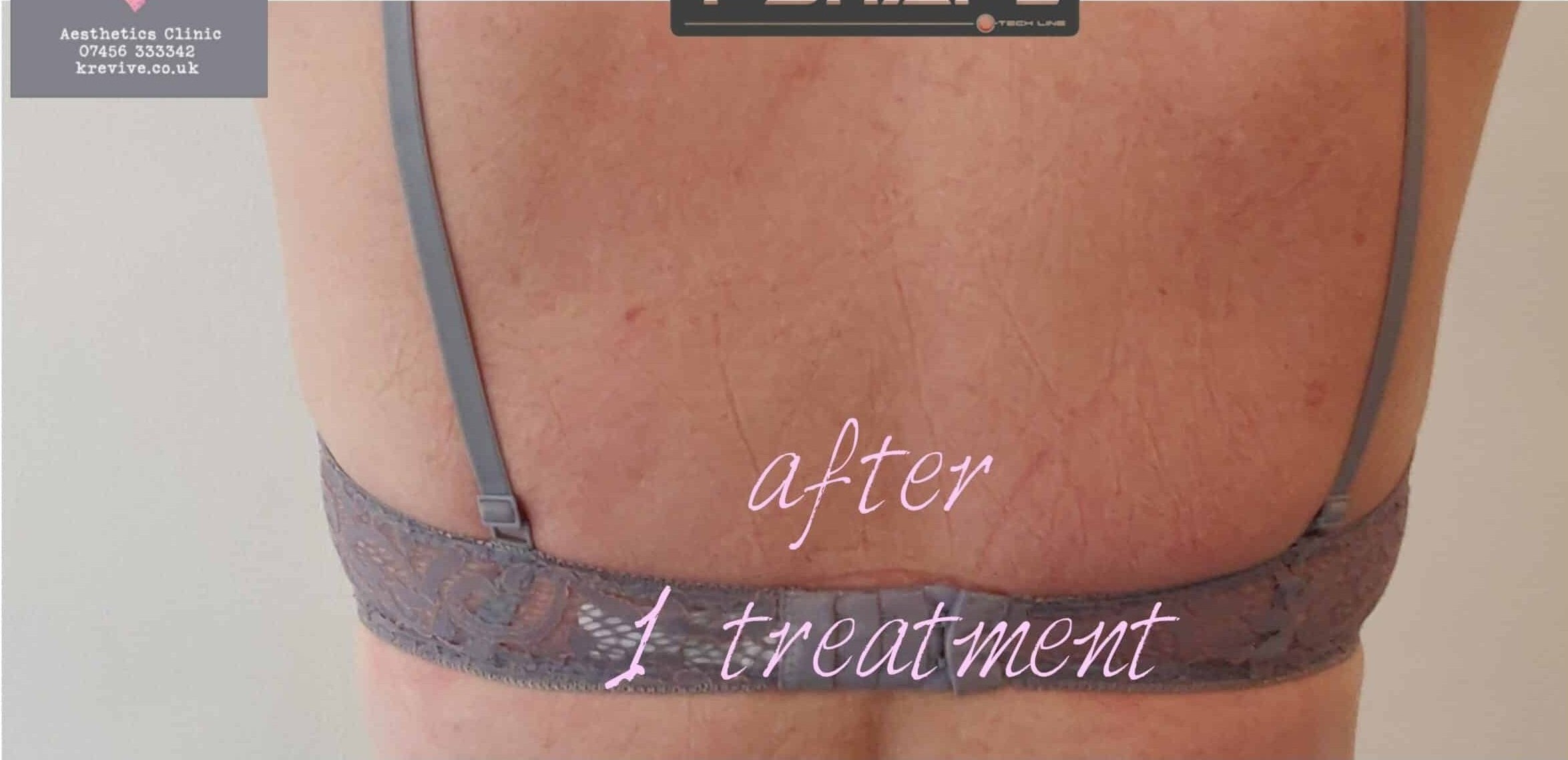After Image: T-Shape 2 - back