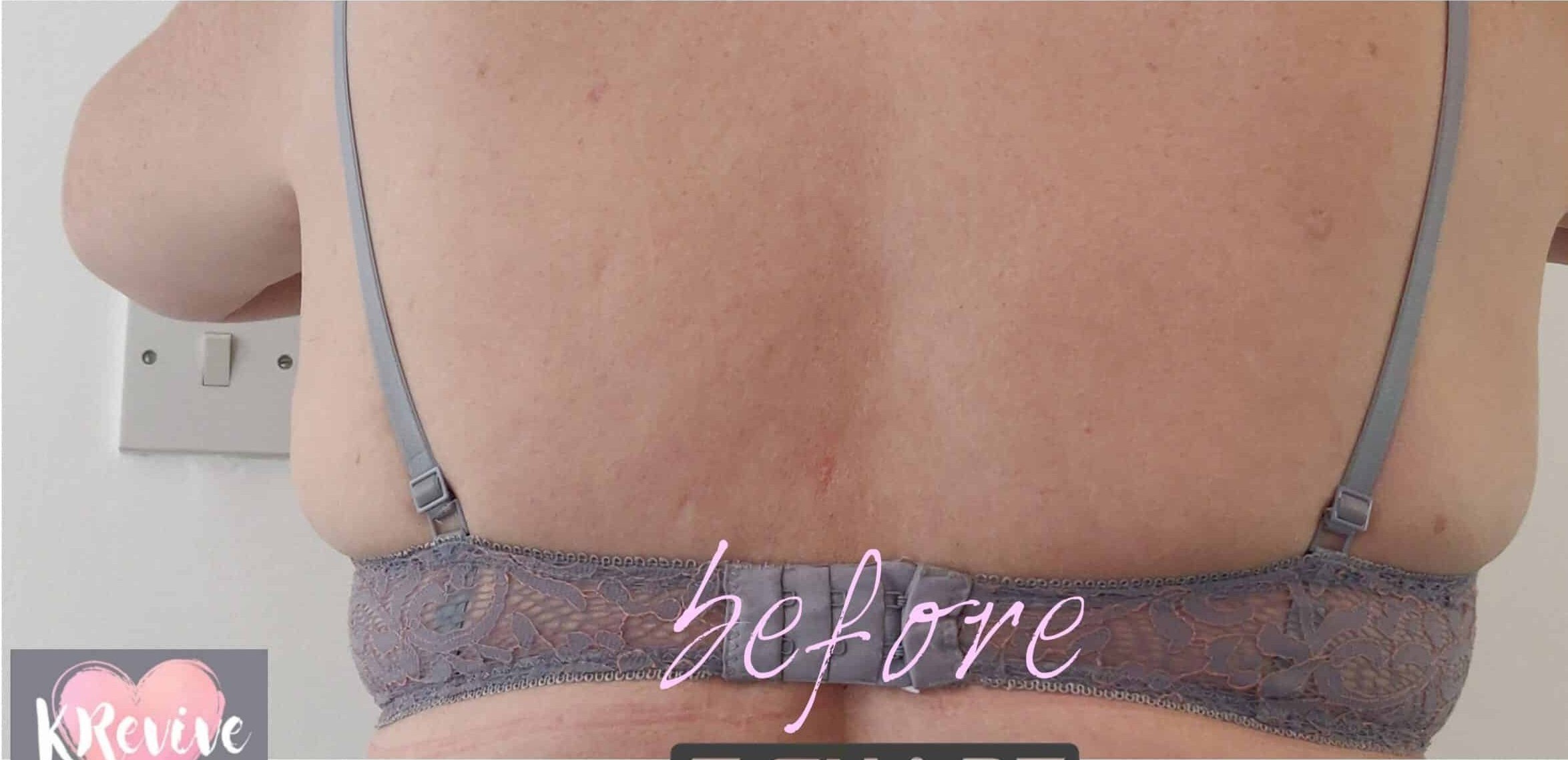 Before Image: T-Shape 2 - back
