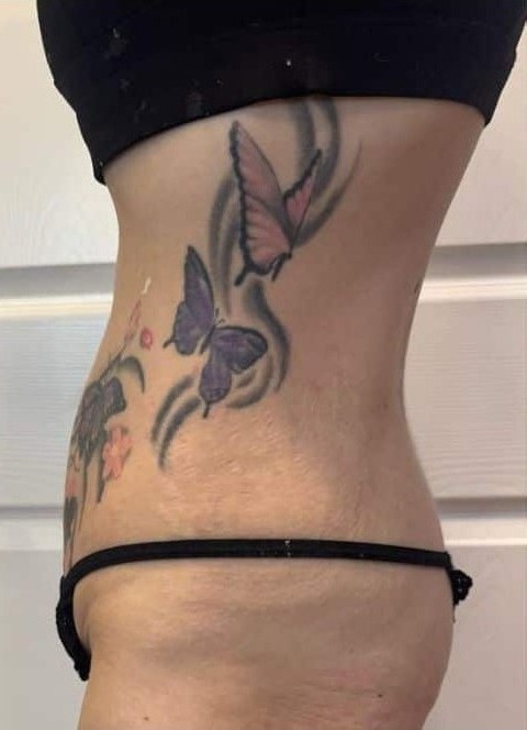 After Image: T-Shape 2 - left-side