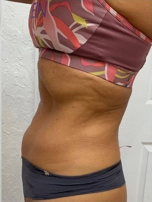 After Image: T-Shape 2 - left-side