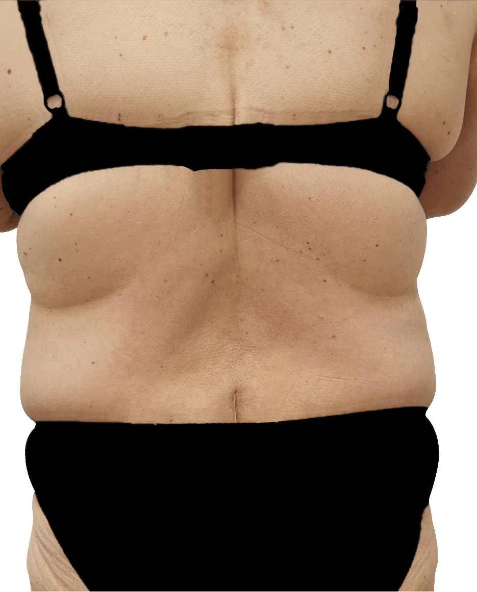 After Image: T-Shape 2 - back