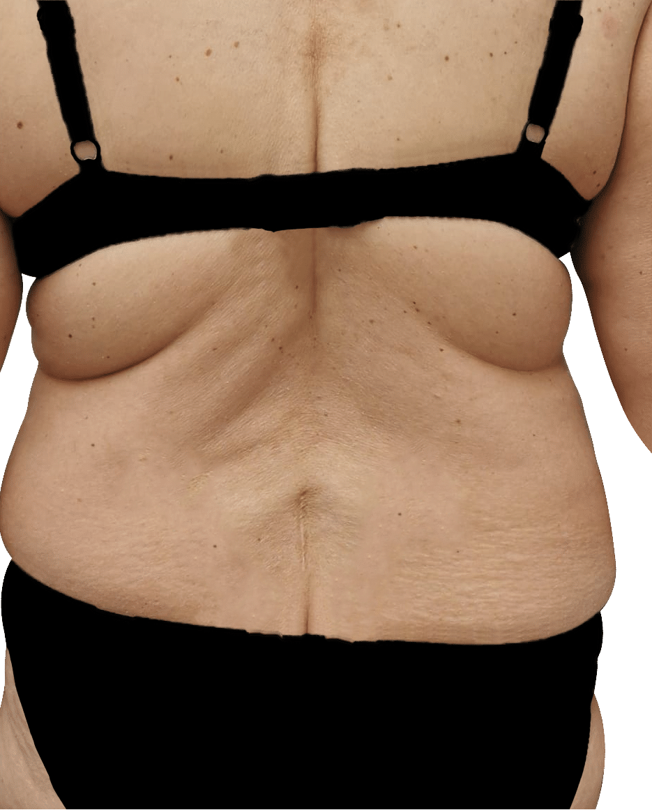 Before Image: T-Shape 2 - back