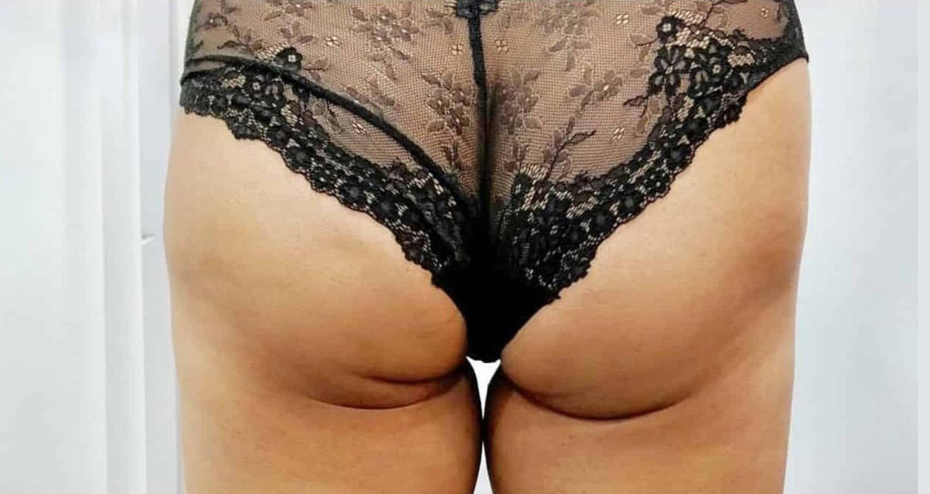 Before Image: T-Shape 2 - back