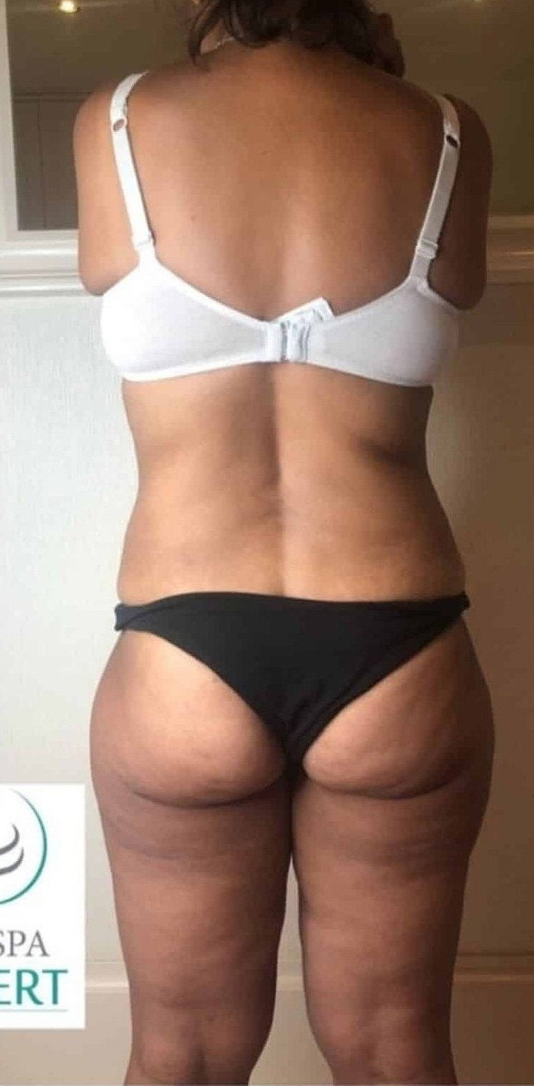 After Image: T-Shape 2 - back