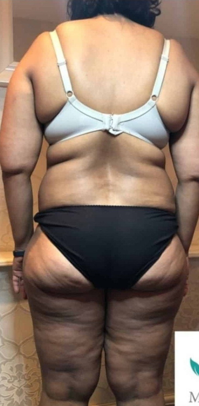 Before Image: T-Shape 2 - back