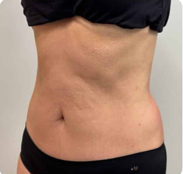 After Image: T-Shape 2 - left-front-oblique
