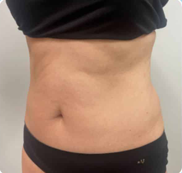 Before Image: T-Shape 2 - left-front-oblique