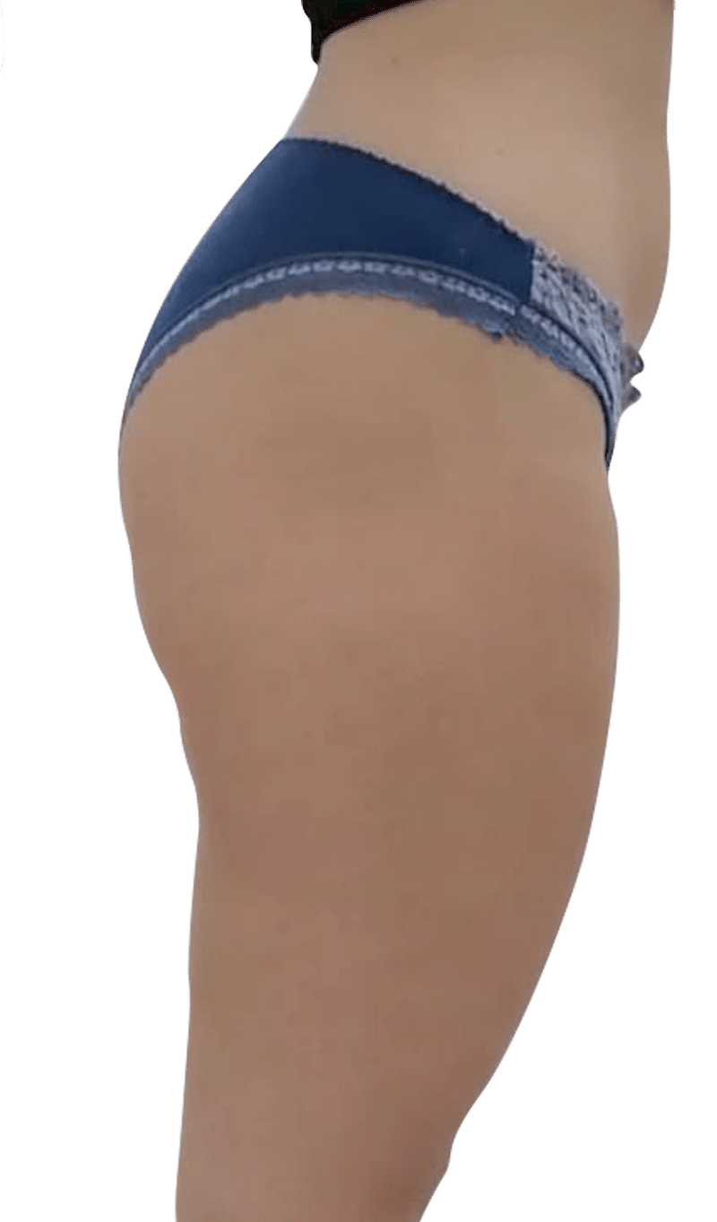 After Image: T-Shape 2 - right-side