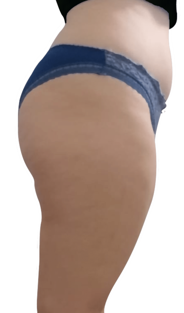 Before Image: T-Shape 2 - right-side