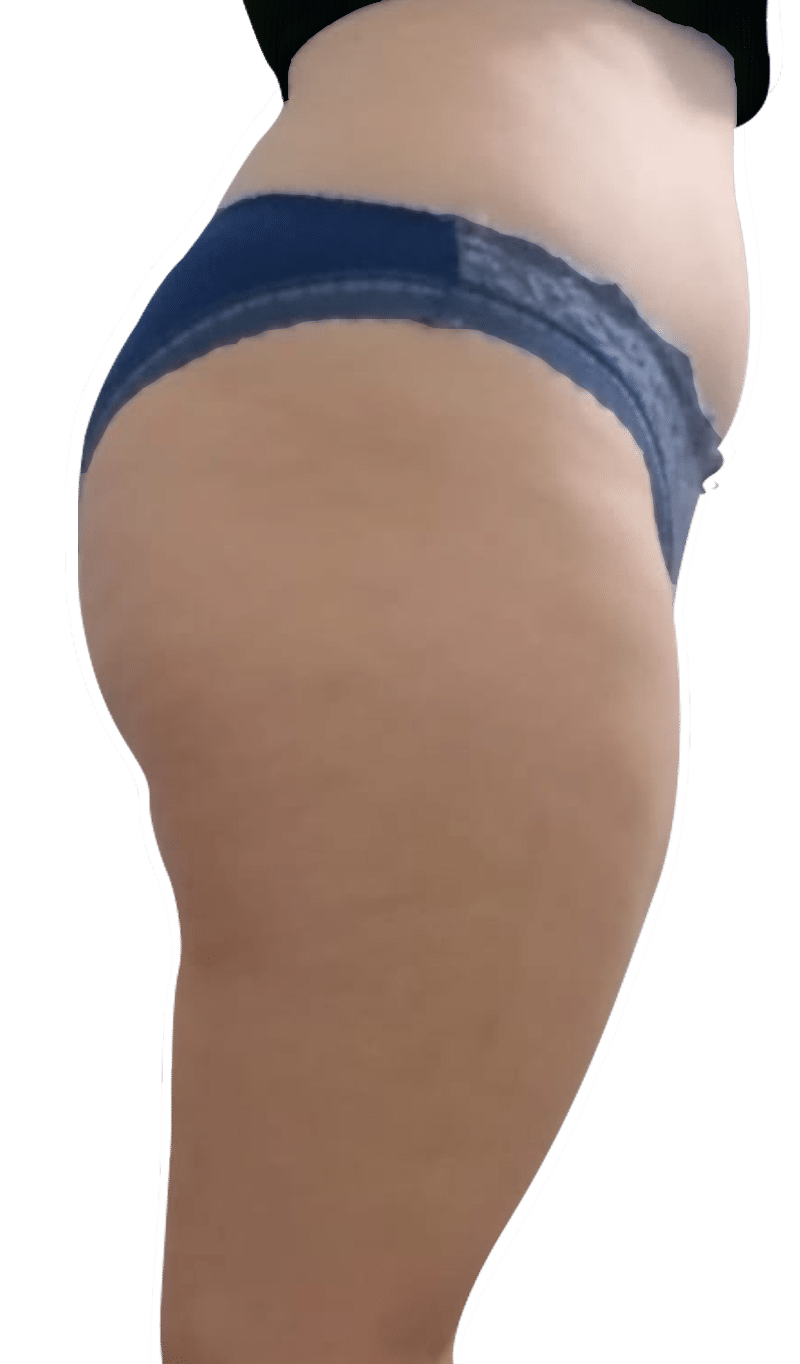Before Image: T-Shape 2 - right-side